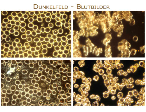 Dunkelfeld-Mikroskopie Workshop!!!